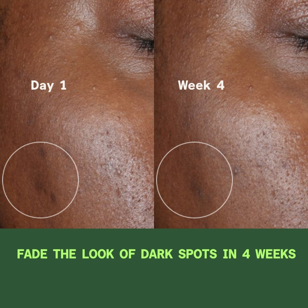 Brighten and Smooth System