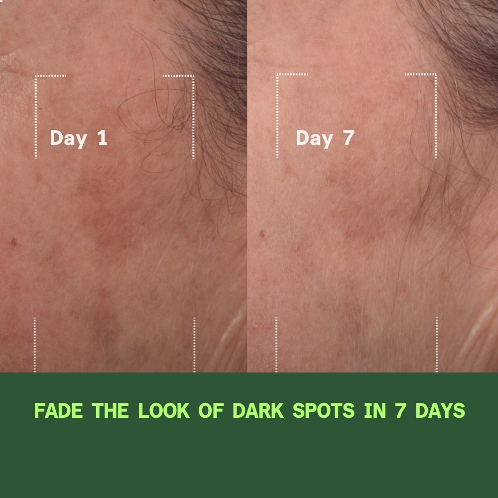 Brighten and Smooth System